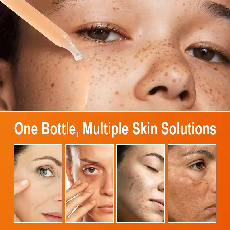 Vitamin C Glow Serum – Brighten & Fade Spots